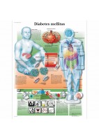 DIABETES MELLITUS (VR-3441)