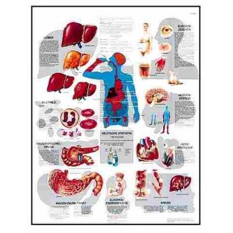 ENFERMEDADES CAUSADAS POR EL ALCOHOL (VR-3790)