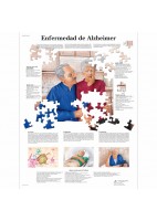ENFERMEDAD DE ALZHEIMER (VR-3628)