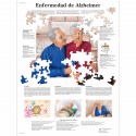 ENFERMEDAD DE ALZHEIMER (VR-3628)
