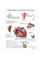 ENFERMEDADES MAS FRECUENTES DEL CORAZON (VR-3343)