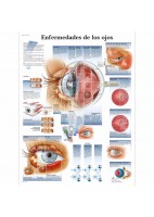ENFERMEDADES DE LOS OJOS (VR-3231)