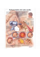 ENFERMEDADES DEL OIDO MEDIO (VR-3252)