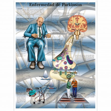 ENFERMEDAD DE PARKINSON (VR-3629)
