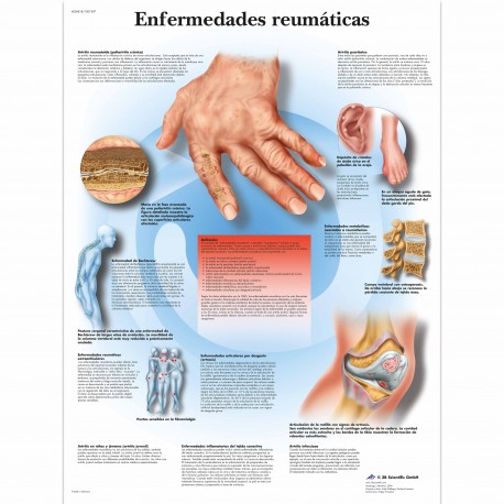 ENFERMEDADES REUMATICAS (VR-3124)