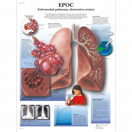 EPOC (VR-3329)