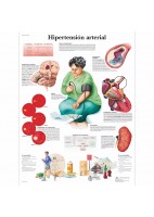 HIPERTENSION ARTERIAL (VR-3361)