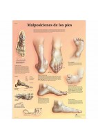 MALPOSICIONES DE LOS PIES (VR-3185)