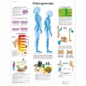 OSTEOPOROSIS (VR-3121)
