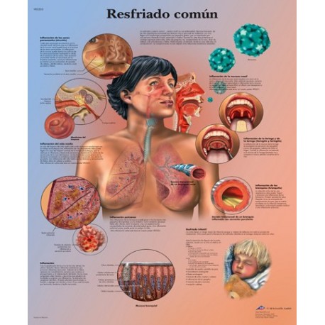 RESFRIADO COMUN (VR-3253)
