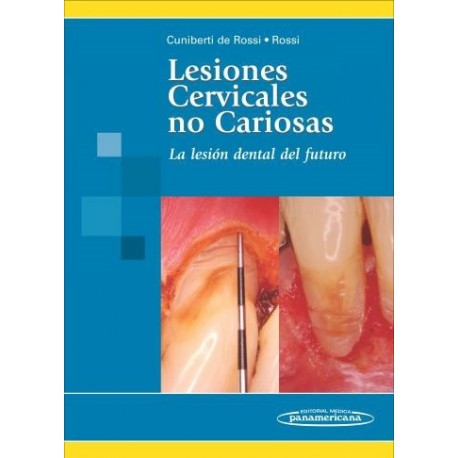 LESIONES CERVICALES NO CARIOSAS. LA LESION DENTAL DEL FUTURO
