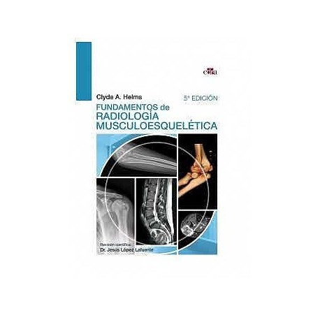FUNDAMENTOS DE RADIOLOGIA MUSCULOESQUELETICA
