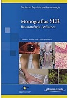MONOGRAFIAS SER. REUMATOLOGIA PEDIATRICA