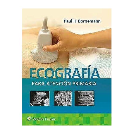 ECOGRAFIA PARA ATENCION PRIMARIA