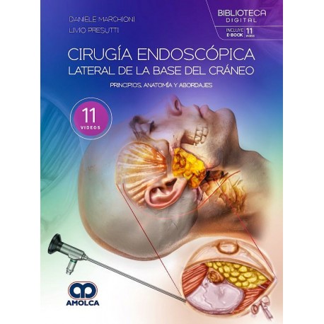 CIRUGIA ENDOSCOPICA LATERAL DE LA BASE DEL CRANEO.PRINCIPIOS, ANATOMIA Y ABORDAJES