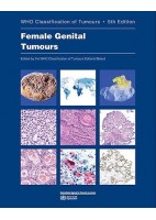 WHO CLASSIFICATION OF TUMOURS: FEMALE GENITAL TUMOURS