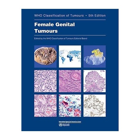 WHO CLASSIFICATION OF TUMOURS: FEMALE GENITAL TUMOURS