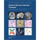 WHO CLASSIFICATION OF TUMOURS: CENTRAL NERVOUS SYSTEM TUMOURS
