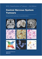 WHO CLASSIFICATION OF TUMOURS: CENTRAL NERVOUS SYSTEM TUMOURS