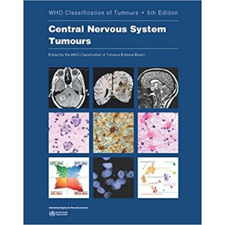 WHO CLASSIFICATION OF TUMOURS: CENTRAL NERVOUS SYSTEM TUMOURS