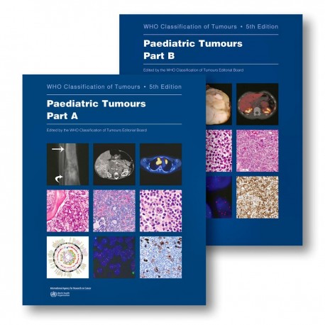 WHO CLASSIFICATION OF TUMOURS: PAEDIATRIC TUMOURS (PART A AND B (2 VOLUME SET)