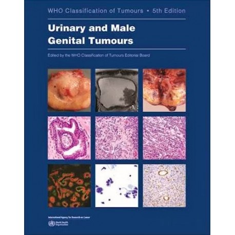 WHO CLASSIFICATION OF TUMOURS: URINARY AND MALE GENITAL TUMOURS