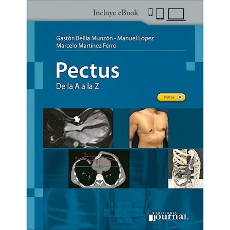 PECTUS. DE LA A A LA Z