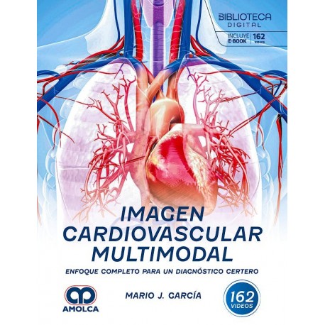 IMAGEN CARDIOVASCULAR MULTIMODAL. ENFOQUE COMPLETO PARA UN DIAGNOSTICO CERTERO