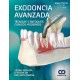 EXODONCIA AVANZADA. TECNICAS Y ENFOQUES CLINICOS MODERNOS