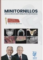 MINITORNILLOS. APLICACION DE MINITORNILLOS EN ORTODONCIA