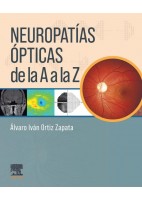 NEUROPATIAS OPTICAS DE LA A A LA Z