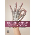PROTESIS EN MANO, MUÑECA Y CODO.