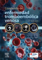 COMPENDIO DE ENFERMEDAD TROMBOEMBOLICA VENOSA
