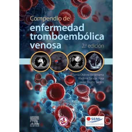 COMPENDIO DE ENFERMEDAD TROMBOEMBOLICA VENOSA