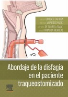 ABORDAJE DE LA DISFAGIA EN EL PACIENTE TRAQUEOSTOMOTIZADO