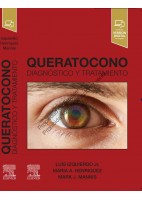 QUERATOCONO. DIAGNOSTICO Y TRATAMIENTO (INCLUYE VERSION DIGITAL EN INGLES)