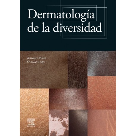 DERMATOLOGIA EN LA DIVERSIDAD