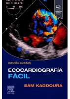 ECOCARDIOGRAFIA FACIL
