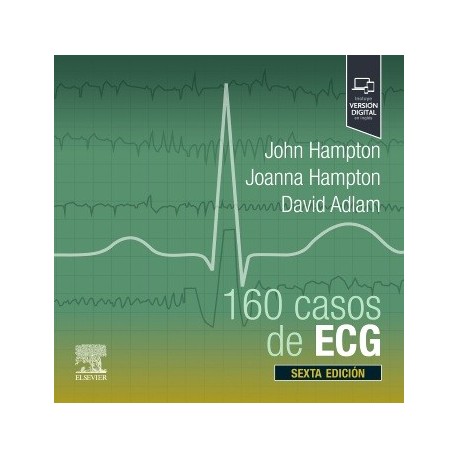 160 CASOS DE ECG