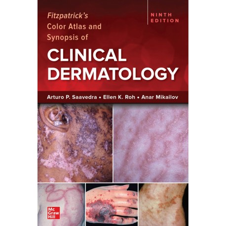 FITZPATRICK'S COLOR ATLAS AND SYNOPSIS OF CLINICAL DERMATOLOGY
