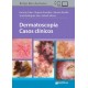 DERMATOSCOPIA. CASOS CLINICOS
