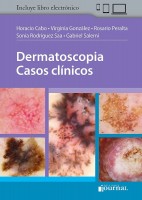DERMATOSCOPIA. CASOS CLINICOS
