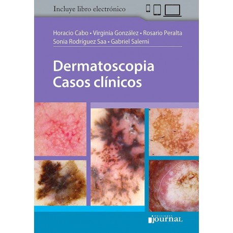 DERMATOSCOPIA. CASOS CLINICOS