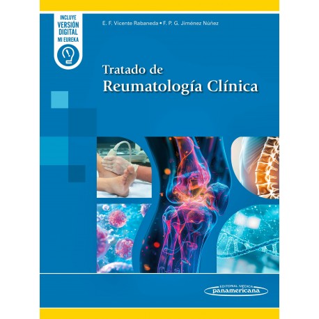 TRATADO DE REUMATOLOGIA CLINICA