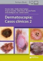 DERMATOSCOPIA. CASOS CLINICOS 2