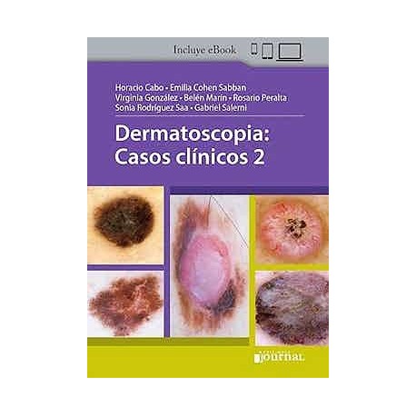 DERMATOSCOPIA. CASOS CLINICOS 2