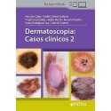 DERMATOSCOPIA. CASOS CLINICOS 2