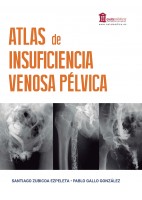 ATLAS DE INSUFICIENCIA VENOSA PELVICA