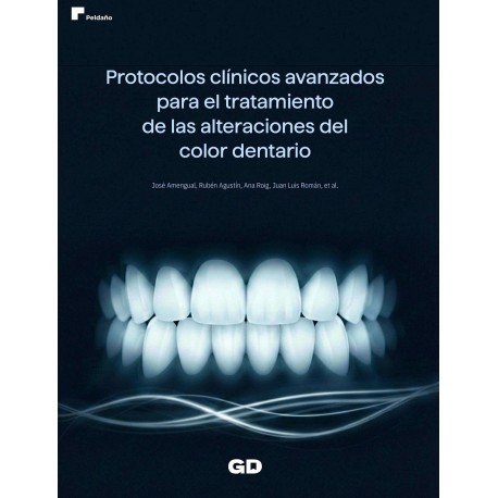 PROTOCOLOS CLINICOS AVANZADOS PARA EL TRATAMIENTO DE LAS ALTERACIONES DEL COLOR DENTARIO