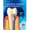 PLANIFICACION DEL TRATAMIENTO EN IMPLANTOLOGIA DENTAL
